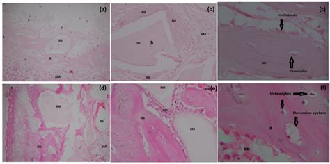 Materials Free Full Text Osteogenic Induction With Silicon
