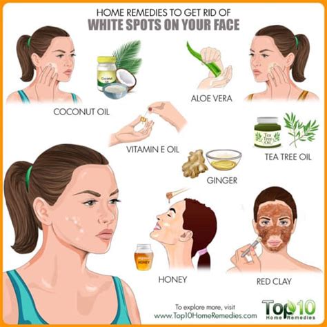 Maybe you would like to learn more about one of these? Home Remedies to Get Rid of White Spots on Face | Top 10 ...