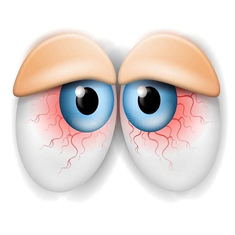 Droopy Tired Bloodshot Eyes An Illustration Featuring A Pair Of
