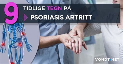 9 Early Signs Of Psoriasis Arthritis Symptoms And Clinical Signs
