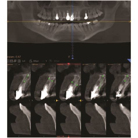 Cone Beam Computed Tomography Cbct The Cone Beam Computed Tomography