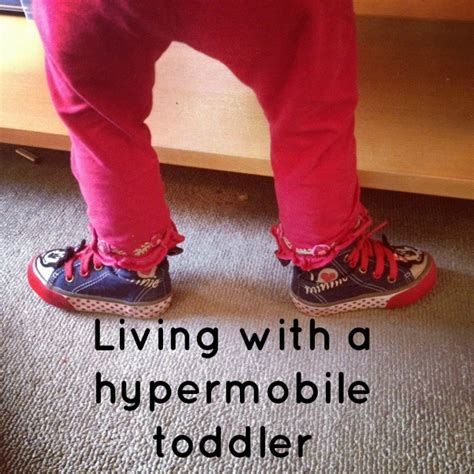 Living With A Hypermobile Toddler