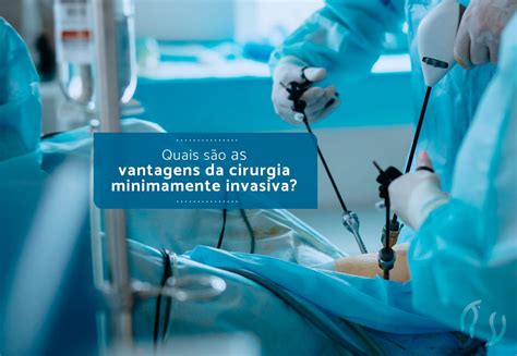 Quais S O As Vantagens Da Cirurgia Minimamente Invasiva Dr Luiz Fl Vio