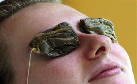 How To Use Tea Bags To Help Cure Styes