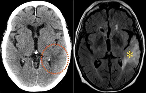 Cat Scan Vs Mri Vs Xray