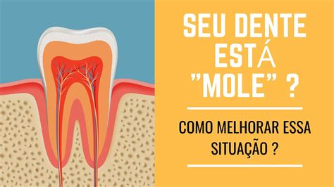 Como Fixar Um Dente Mole