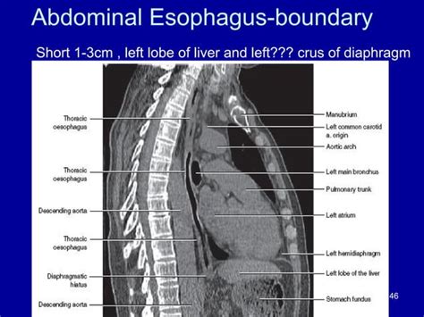 Radiological Anatomy Of Pharynx And Esophagus Abdul Final