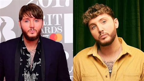 james arthur s plastic surgery why does his face look different