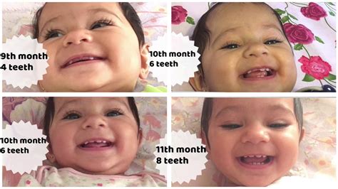 How Many Teeth Does An 11 Month Old Baby Have Teethwalls