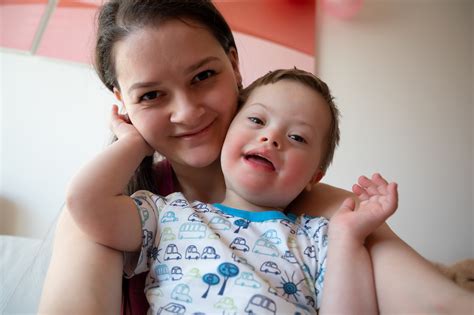 The chance of having a second baby with down syndrome is approximately 1%. Down Syndrome (Trisomy 21) | babyMed.com