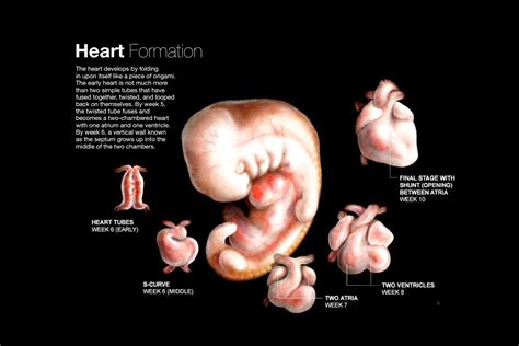 How Common Is Critical Congenital Heart Disease StoryMD