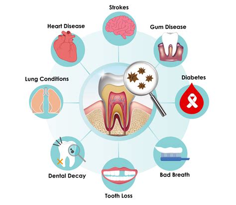 Beyond Tooth Decay Why Good Dental Hygiene Is Important