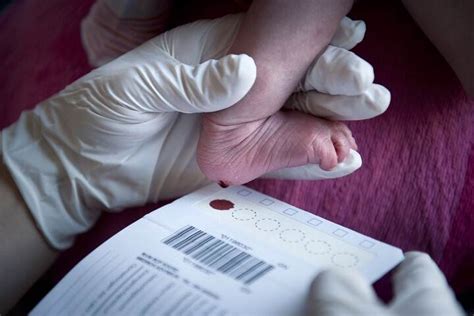Results Of Initial Evaluation Into Newborn Blood Spot Screening
