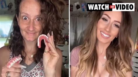 toothless mum shows off incredible false teeth transformation photos gold coast bulletin