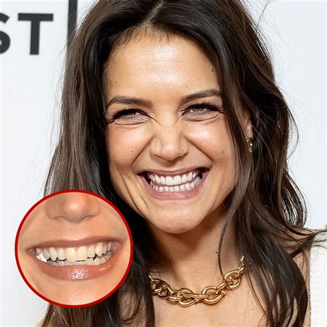 Hollywood Stars And Veneers Before And After Social Social Social Social Social Social