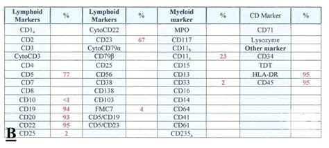 Chronic Lymphocytic Leukemia Cll With Presence Of Pro Lymphocytes 7
