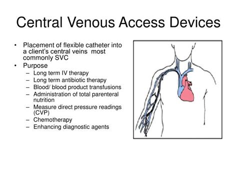 Ppt Hyperalimentation And Central Venous Catheters Powerpoint