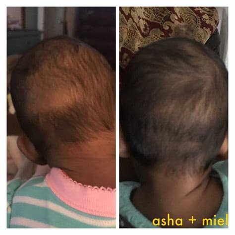 Whatever it is, a baby's hair needs gentle, efficient maintenance, provided by the right hair oil. Pure Coconut Cradle Cap Oil, Gentle Herbal Baby Hair Balm ...