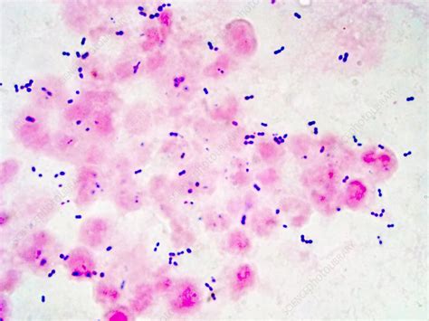 Streptococcus Pneumoniae Bacteria Stock Image B2360160 Science