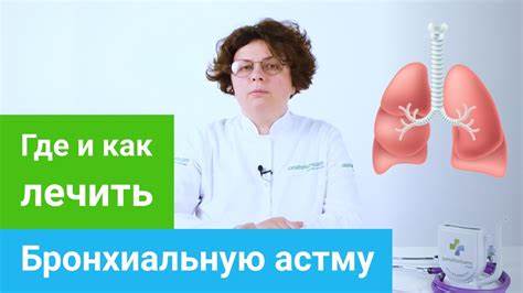 Диета при мкб номер