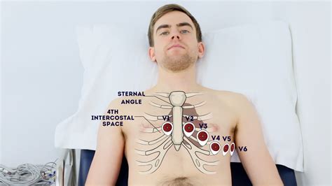 How To Record An Ecg Osce Guide Procedure Geeky Medics