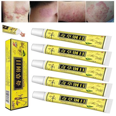 Buy Nobrand1 5pcs Lot Chinese Al Eczema Psoriasis Creameczema Cream