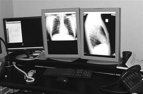 Pacs Fundamentals Radiology Key