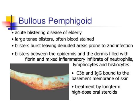 Ppt Non Infectious Skin Diseases Powerpoint Presentation Id210732