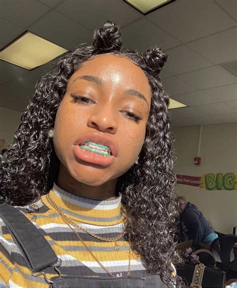 Sun ️ Braces Colors Brace Face Cute Girls With Braces