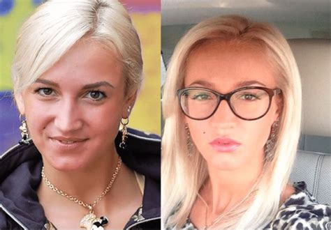 Анализ фото бузовой в детстве, юности и сейчас. Бузова. Фото до и после пластики носа, губ, скул. Как ...