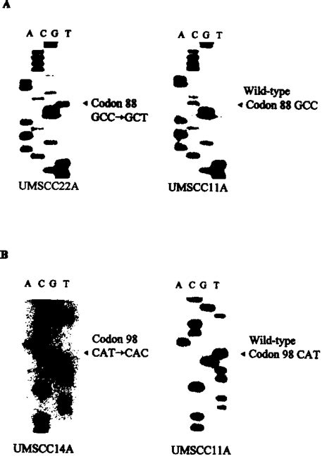 Gene In Head And Neck Cancer Cell Lines A Candidate Tumor