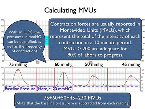 Are these readings normal? acidosis.: Pin on L&D/ Maternity/ Newborn