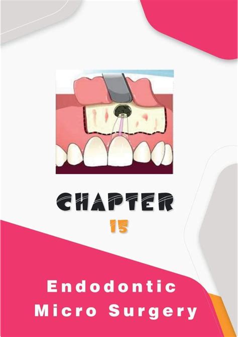 Endodontic Microsurgery Dental Anatomy Studocu