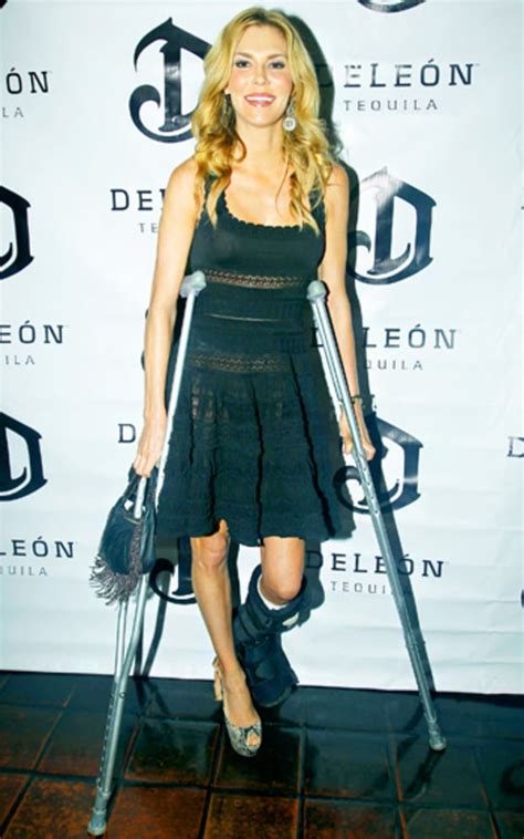 73:48 nsps 175 my wifey wants another man's manhood: Brandi Glanville | Celebrity Injuries | Us Weekly