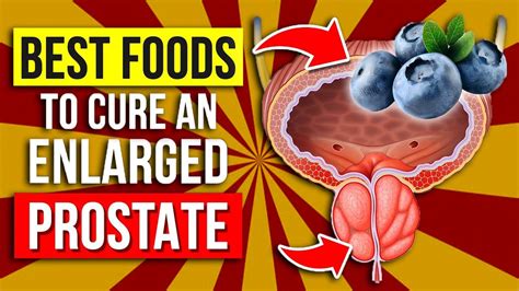 These Are The Best And Worst Foods For Enlarged Prostate Youtube