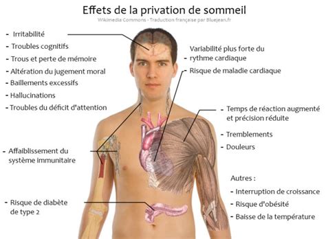 5 Effets néfastes du manque de sommeil sur la santé