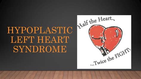 Hypoplastic Left Heart Syndrome Ppt