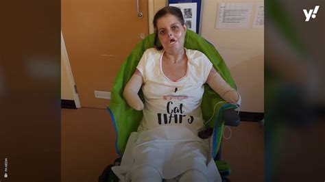 Mum Who Lost Limbs To Sepsis Looking Forward To Hugging Her Children
