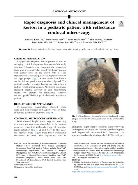 Pdf Rapid Diagnosis And Clinical Management Of Kerion In A Pediatric