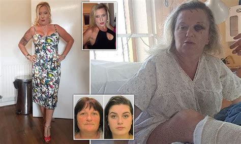 Mother Battered In Vile Attack By Mother And Daughter Who Were Jealous Of Her Looks