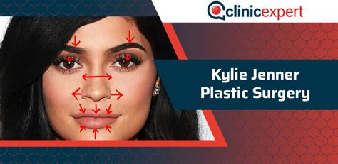 Kylie Jenner Plastic Surgery Journey Clinicexpert