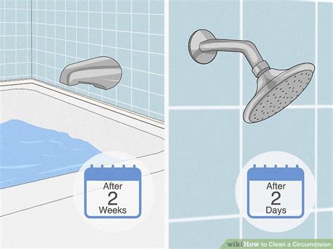How To Clean A Circumcision Steps With Pictures Wikihow