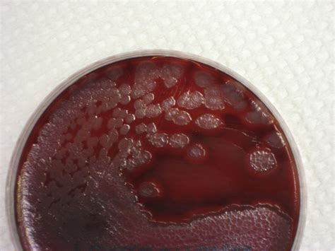 Pseudomonas Aeruginosa On Bap