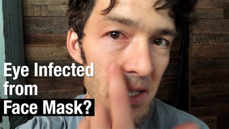 Your Face Mask Is Dirty—infected Eye From My Mask 🤷🏾 Youtube