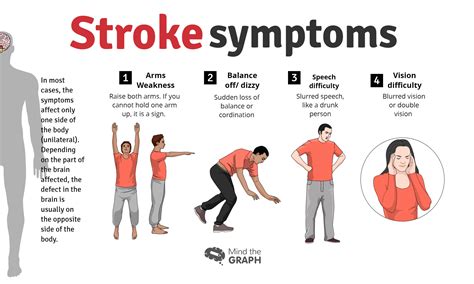 Stroke Symptoms Cardiology Mind The Graph Blog