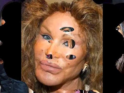 Plastic Surgery Gone Horribly Wrong Worst Plastic Surgery Ever Version