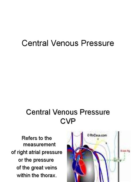 Central Venous Pressure Intravenous Therapy Vein