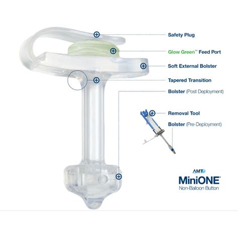 Amt Mini One Enfit Obturated Non Balloon Button Feeding Device