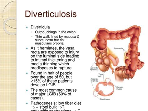 Ppt Gastrointestinal Bleeding Powerpoint Presentation Id547157