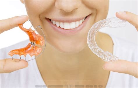 What To Do After Losing Your Retainers Wiewiora And Dunn Orthodontics